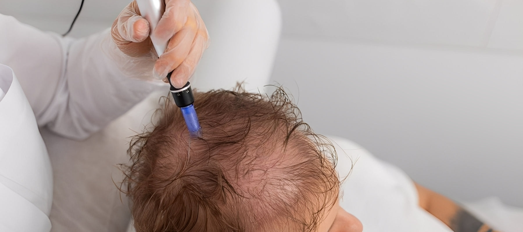 Volupropol Treatment