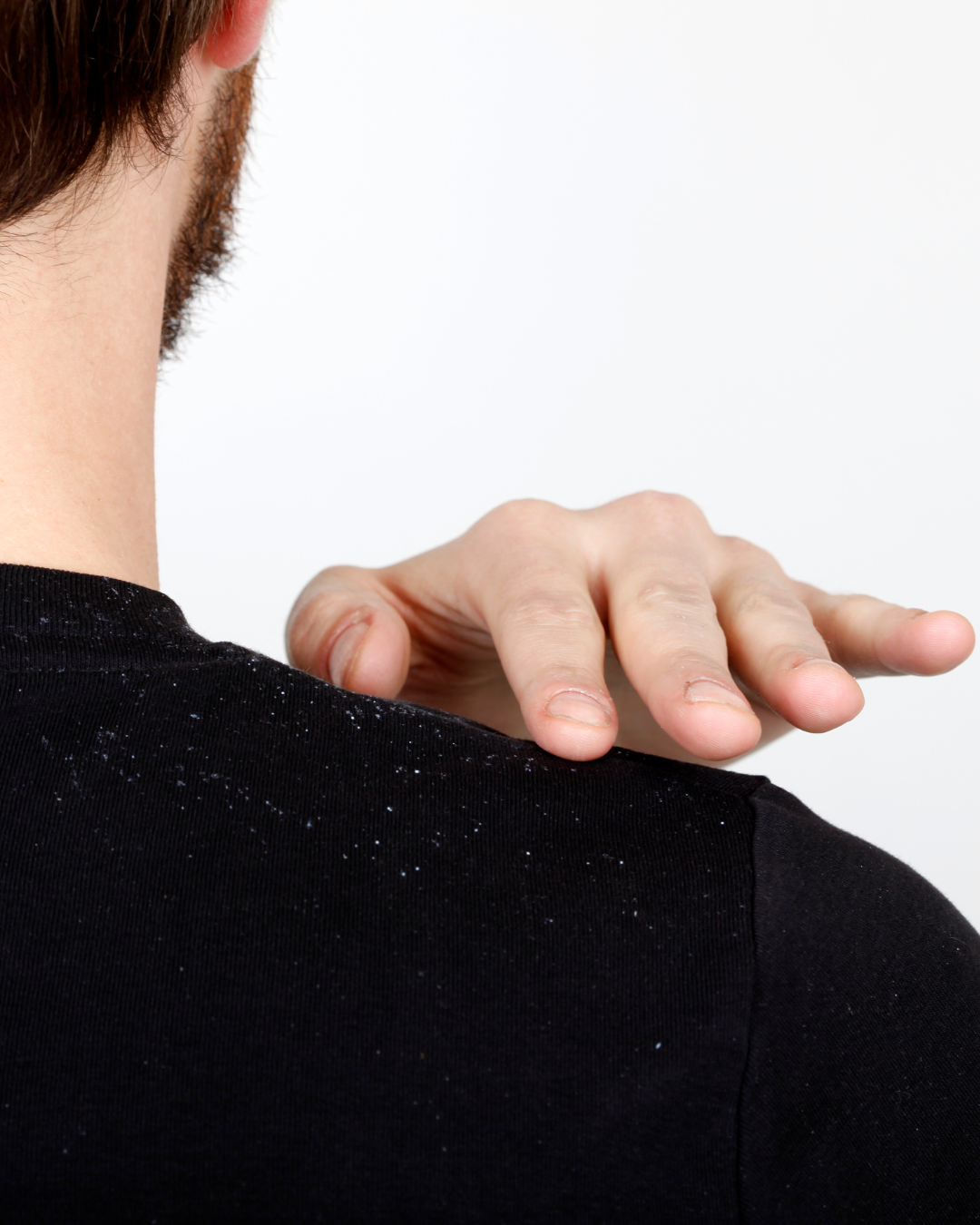VOLUMED PACKAGE 3: ANTI-DANDRUFF